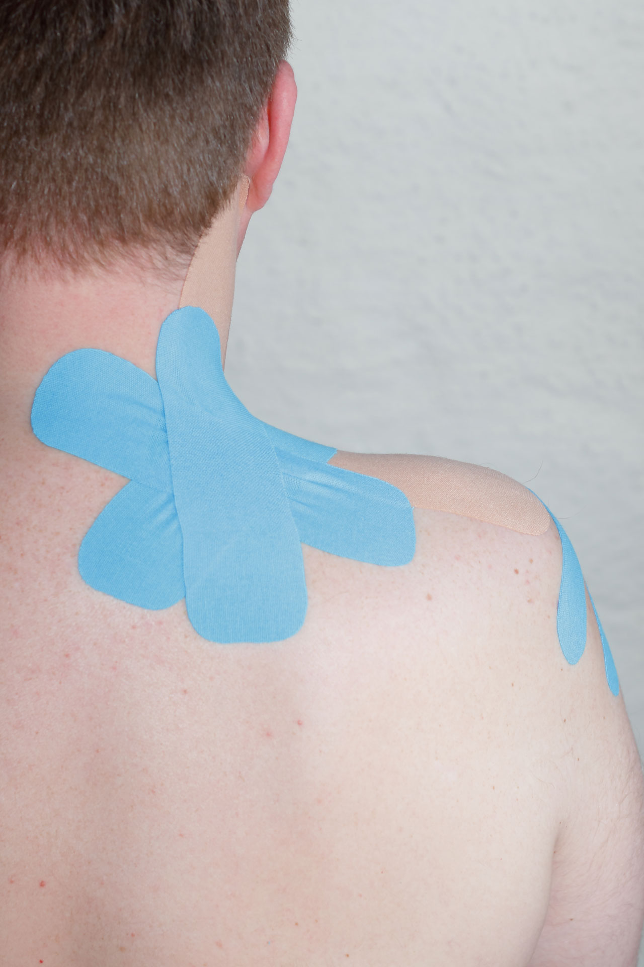 Kinesio-Taping